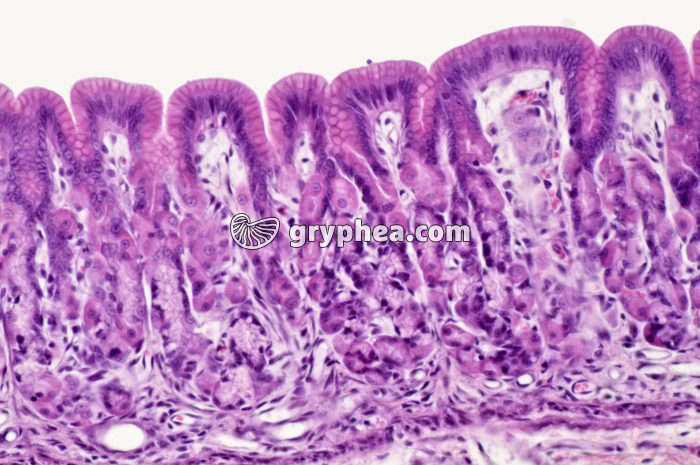 Estomac pylorique x100 - gryphea.org